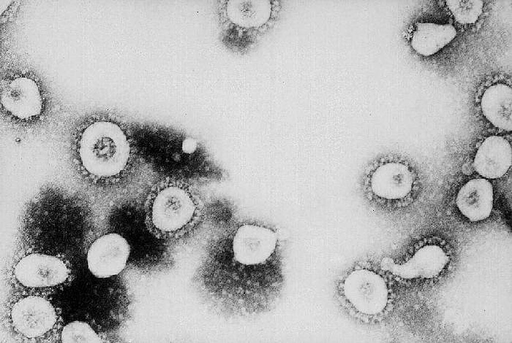 Abbiamo raggiunto i 20 milioni di casi di coronavirus nel mondo