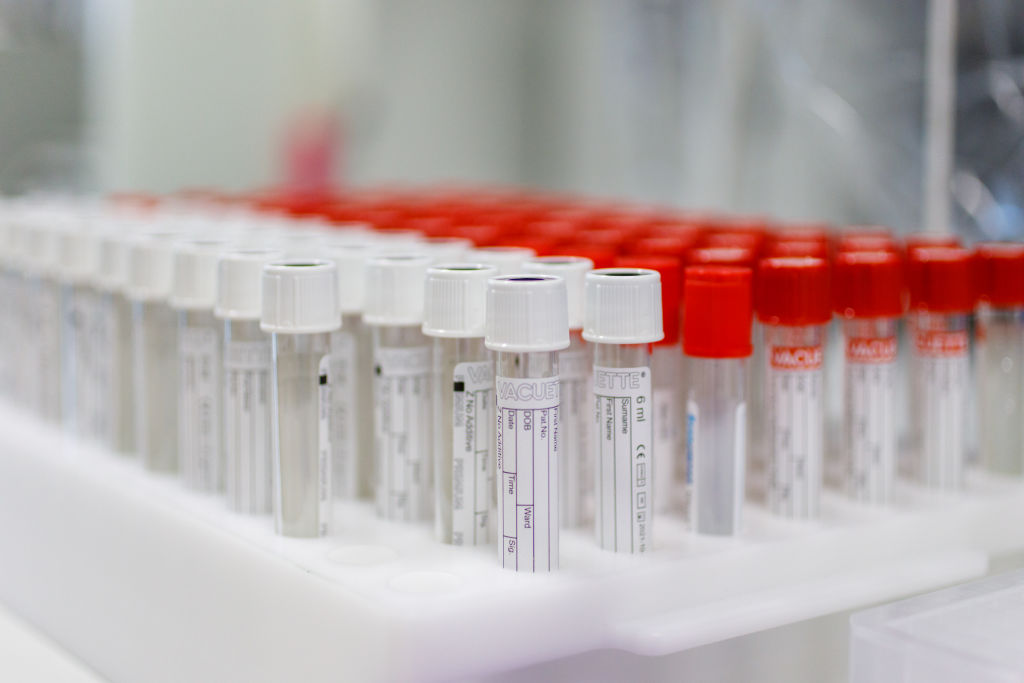 AstraZeneca ha nascosto 29 milioni di dosi di vaccino anti-Covid in Italia