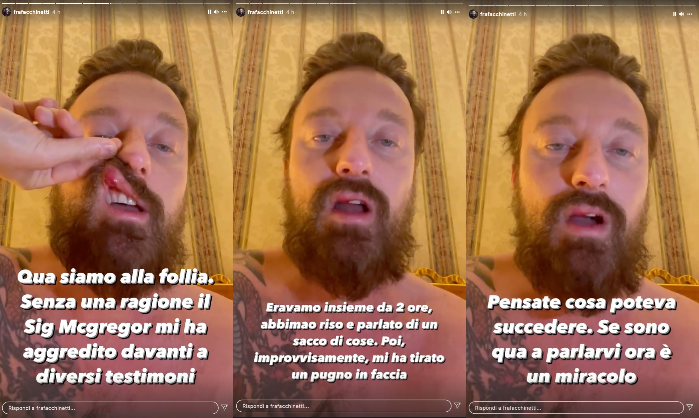 Francesco Facchinetti è stato aggredito dal pugile Conor McGregor